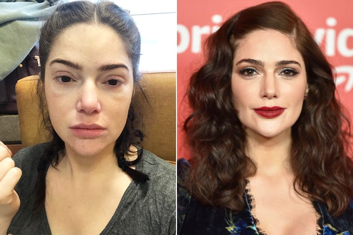 Did Janet Montgomery Have Plastic Surgery Everything